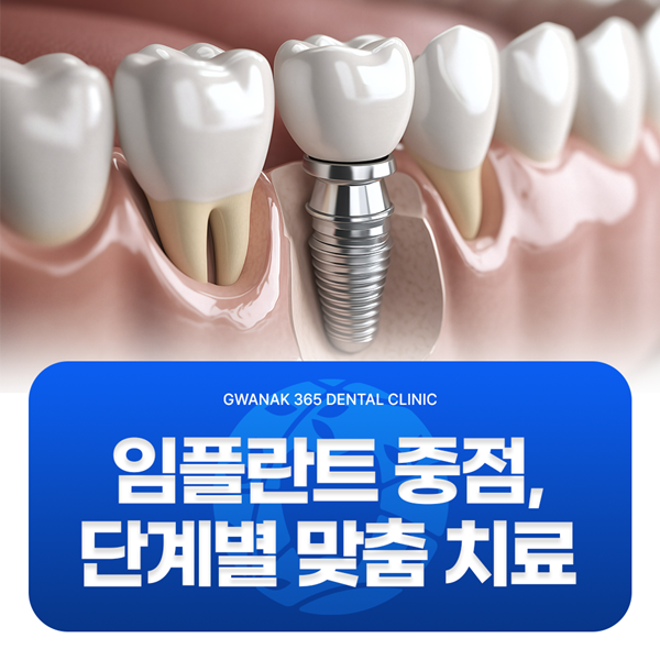 임플란트 중점치료, 단계별 맞춤치료로 꼼꼼하게 받으세요
