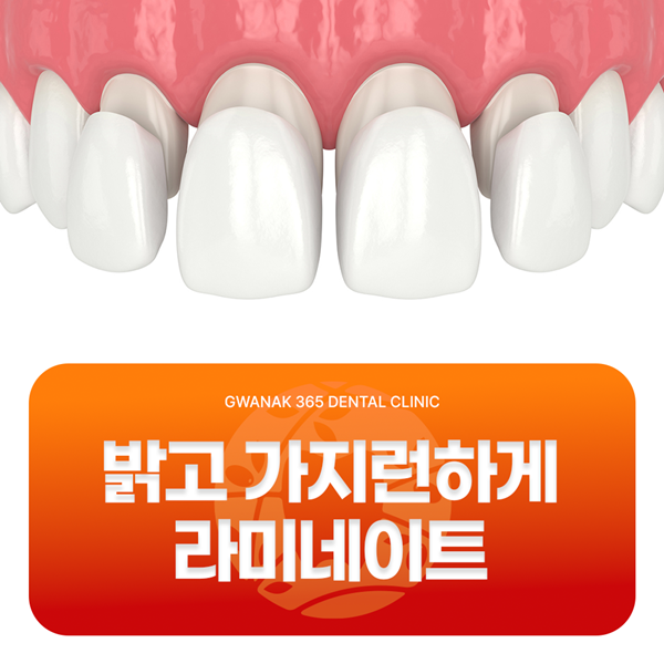 밝고 가지런하게 라미네이트 환한미소