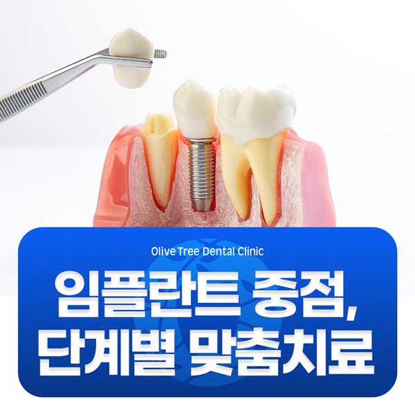 임플란트 중점, 단계별 맞춤치료로 진료합니다.